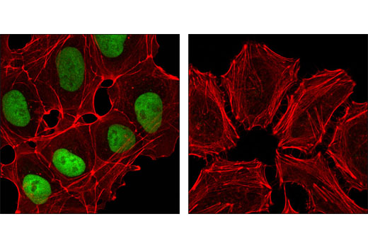Confocal immunofluorescent analysis of NTERA-2 cells (left) and HeLa cells (right) using Nanog (D73G4) XP ® Rabbit mAb (green). Actin filaments have been labeled with DY-554 phalloidin (red).
