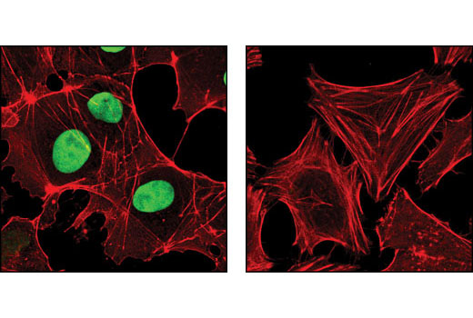 Confocal immunofluorescent analysis of NTERA2 (left) and HeLa (right) cells using Sox2 (D6D9) XP ® Rabbit mAb (green). Actin filaments have been labeled with DY-554 phalloidin (red).