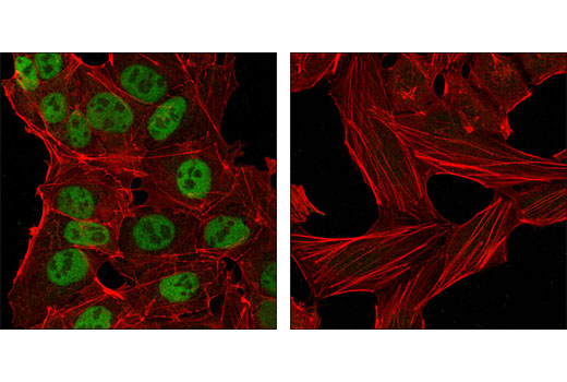 Confocal immunofluorescent analysis of NTERA-2 cells (left) and HeLa cells (right) using Nanog (1E6C4) Mouse mAb (green). Actin filaments have been labeled with DY-554 phalloidin (red).