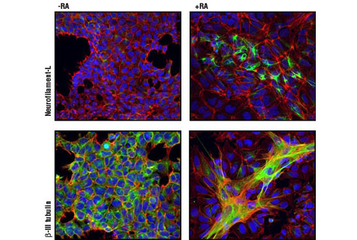 Confocal immunofluorescent analysis of NTERA-2 cells, untreated (left panel) or retinoic acid-treated (10 µM all-trans RA for 5 days) (right panel), using Neurofilament-L (C28E10) Rabbit mAb #2837 (green, upper), and β3-Tubulin (TU-20) Mouse mAb #4466 (green, lower). Actin filaments have been labeled with DY-554 phalloidin (red). Blue pseudocolor = DRAQ5 ® #4084 (fluorescent DNA dye). Note the appearance of neuronal markers and structures as cells differentiate along the neuronal lineage with retinoic acid treatment.