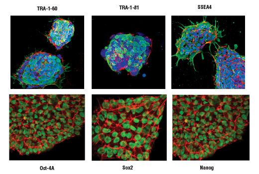 Projected confocal z-stack of human iPS cells using TRA-1-60(S) (TRA-1-60(S)) Mouse mAb (green, upper left), TRA-1-81 (TRA-1-81) Mouse mAb (green, upper middle), SSEA4 (MC813) Mouse mAb (green, upper right), Oct-4A (C30A3) Rabbit mAb (green, lower left), Sox2 (D6D9) XP ® Rabbit mAb (green, lower middle) and Nanog (D73G4) XP® Rabbit mAb (green, lower right). Actin filaments were labeled with DY-554 phalloidin (red). Blue pseudocolor = DRAQ5 ® #4084 (fluorescent DNA dye).