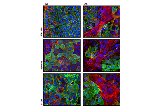 Confocal immunofluorescent analysis of NTERA-2 cells, untreated (left panel) or retinoic acid-treated (10 µM all-trans RA for 5 days) (right panel), using TRA-1-60(S) (TRA-1-60(S)) Mouse mAb (green, upper), TRA-1-81 (TRA-1-81) Mouse mAb (green, middle) and SSEA4 (MC813) Mouse mAb (green, lower). Actin filaments have been labeled with DY-554 phalloidin (red). Blue pseudocolor = DRAQ5 ® #4084 (fluorescent DNA dye). Note the loss of pluripotency markers (green) as cells differentiate along the neuronal lineage with retinoic acid treatment.