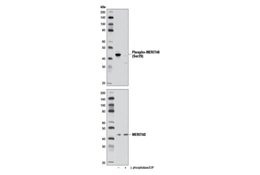 Western blot analysis of extracts from A-431 cells, untreated (-) or treated with λ phosphatase and calf intestinal phosphatase (CIP) (+), using Phospho-MERIT40 (Ser29) Antibody (upper) or MERIT40 Antibody #9500 (lower).