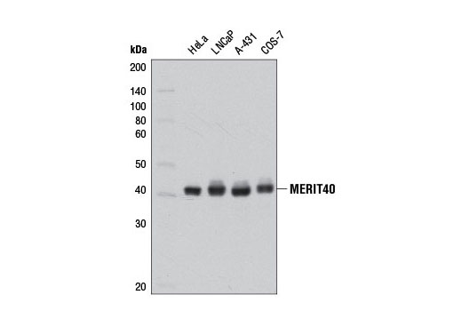 Western blot analysis of extracts from various cell lines using MERIT40 (D7Y5K) Rabbit mAb.