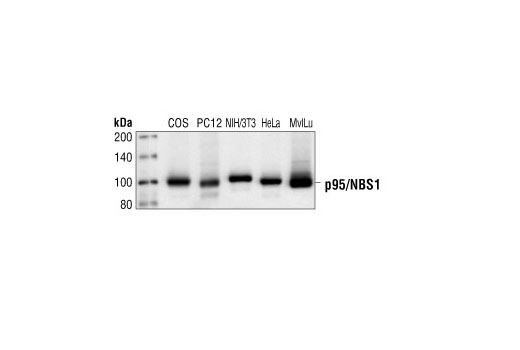 Western blot analysis of extracts from COS, PC12, NIH3T3, HeLa and Mv1Lu cells, using p95/NBS1 Antibody.