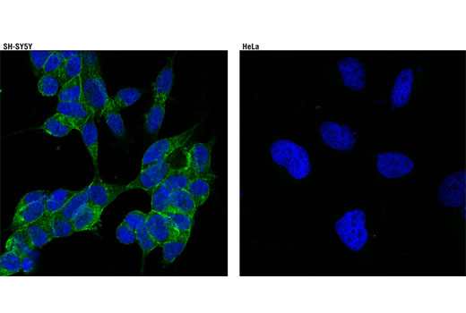 Confocal immunofluorescent analysis of SH-SY5Y cells (left) and HeLa cells (right) using NCAM (CD56) (123C3) Mouse mAb (green). Blue pseudocolor = DRAQ5® #4084 (fluorescent DNA dye).