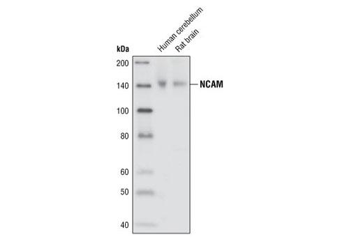 Western blot analysis of extracts from human cerebellum and rat brain, using NCAM (CD56) Antibody.