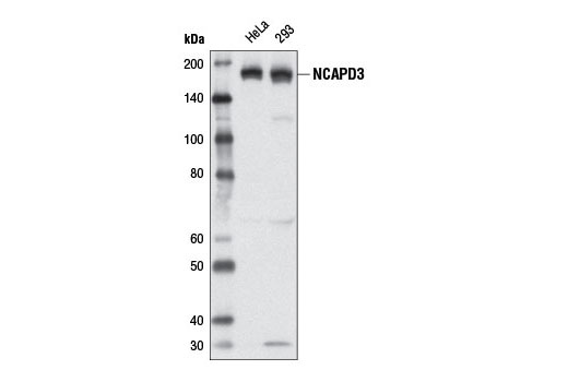 Western blot analysis of extracts from HeLa and 293 cell lines using NCAPD3 (D3H6L) Rabbit mAb.