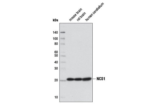 Western blot analysis of extracts from mouse brain, rat brain, and human cerebellum using NCS1 (D12D2) XP ® Rabbit mAb.