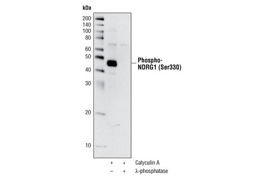 Western blot analysis of extracts from Jurkat cells, treated with Calyculin A #9902 alone (100 nM for 20 min) or together with λ-phosphatase, using Phospho-NDRG1 (Ser330) Antibody.