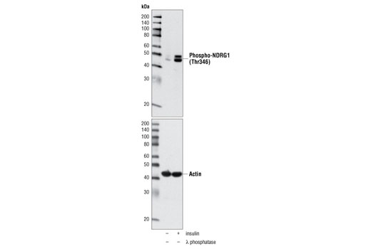 Western blot analysis of extracts from C2C12 cells, untreated, λ phosphatase-treated or treated with insulin for 30 minutes, using Phospho-NDRG1 (Thr346) Antibody (upper) or Actin Antibody #4967 (lower).