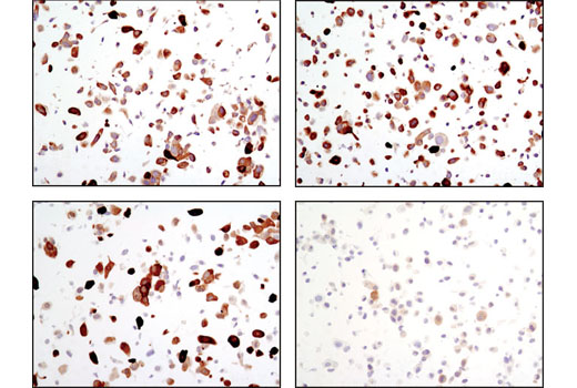 Immunohistochemical analysis on SignalSlide ® Phospho-Akt (Ser473) IHC Controls #8101 [paraffin-embedded LNCaP cell pellets, control (left) or LY294002-treated (right)] using NDRG1 Antibody (top) or Phospho-NDRG1 (Thr346) (D98G11) XP ® Rabbit mAb #5482 (bottom).