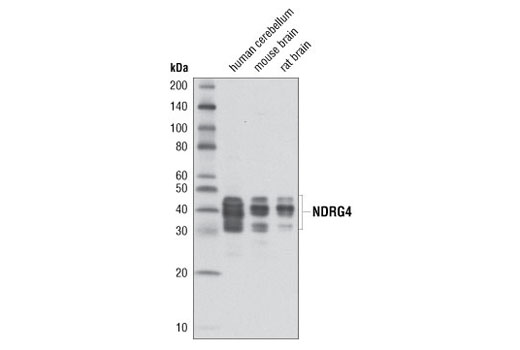 Western blot analysis of extracts from human cerebellum, mouse brain, and rat brain using NDRG4 (D4A6) Rabbit mAb.