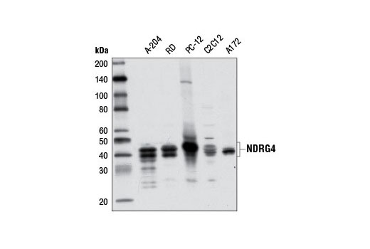Western blot analysis of extracts from various cell lines using NDRG4 (D4A6) Rabbit mAb.
