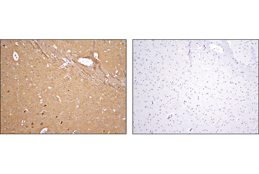 Immunohistochemical analysis of paraffin-embedded mouse brain using NDRG4 (D4A6) Rabbit mAb in the presence of control peptide (left) or antigen-specific peptide(right).