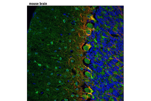 Confocal immunofluorescent analysis of adult mouse brain using NDRG4 (D4A6) Rabbit mAb and Neurofilament-L (C28E10) Rabbit mAb (Alexa Fluor ® 555 Conjugate) #8039 (red). Blue pseudocolor = DRAQ5 ® #4084 (fluorescent DNA dye).