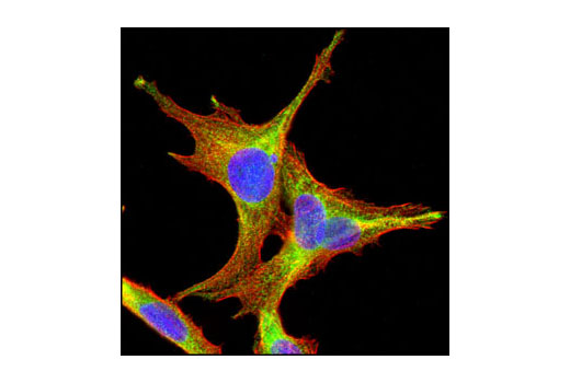 Confocal immunofluorescent analysis of untreated C6 cells using NEDD4 Antibody (green). Blue pseudocolor = DRAQ5 ® #4084 (DNA fluorescent dye).