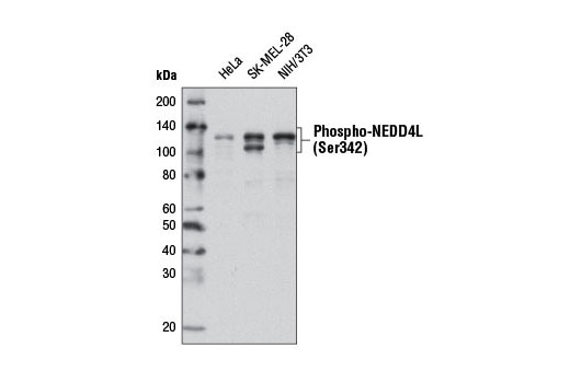 Western blot analysis of extracts from of HeLa, SK-MEL-28, and NIH/3T3 cells using Phospho-NEDD4L (Ser342) (D16D6) Rabbit mAb.