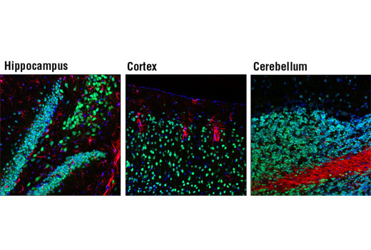 Confocal immunofluorescent analysis of normal mouse hippocampus (left), cortex (middle), and cerebellum (right) using NeuN (D3S3I) Rabbit mAb (green), and GFAP (GA5) Mouse mAb (Alexa Fluor ® 555 Conjugate) #3656 (red). Blue pseudocolor = DRAQ5 ® #4084 (Fluorescent DNA dye).