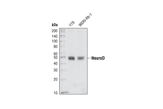 Western blot analysis of extracts from Y79 and WERI-Rb-1 cells, using NeuroD Antibody.