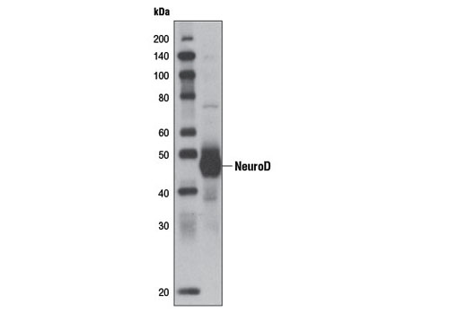 Western blot analysis of extracts from human cerebellum using NeuroD (D90G12) Rabbit mAb.