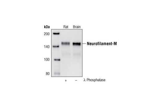 Western blot analysis of extracts from rat brain, untreated or treated with lambda phosphatase, using Neurofilament-M (RMO 14.9) Mouse mAb.