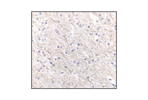 Immunohistochemical analysis of paraffin-embedded human brain, using Neurofilament-M (RMO 14.9) Mouse mAb.
