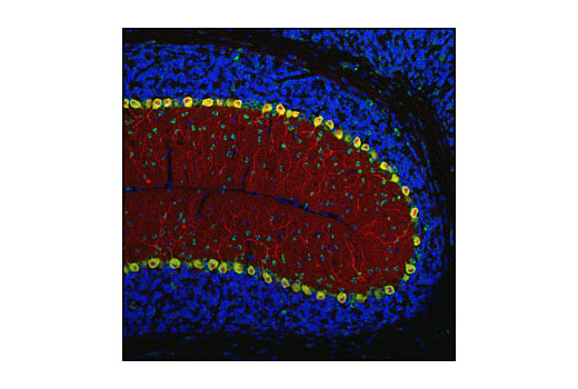 Confocal immunofluorescent image of mouse cerebellum labeled with Neurofilament-M (RMO 14.9) Mouse mAb (green) and Calbindin Antibody #2136 (red). Blue pseudocolor = DRAQ5™ (fluorescent DNA dye).