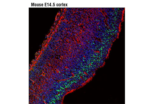 Confocal immunofluorescent analysis of mouse E14.5 cortex using Neurogenin 2 (D2R3D) Rabbit mAb (green). Actin filaments were labeled with DY-554 phalloidin (red). Blue pseudocolor = DRAQ5 ® #4084 (fluorescent DNA dye).