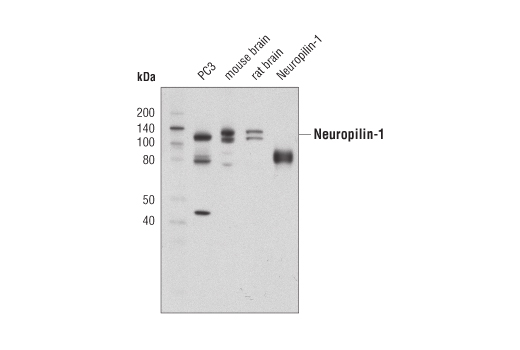 Western blot analysis of extracts from PC3 cells, mouse brain, rat brain, and His-tagged Neuropilin-1 recombinant protein(1-644) using Neuropilin-1 (D62C6) Rabbit mAb.