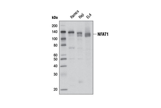 Western blot analysis of extracts from Ramos, Raji, and EL4 cells using NFAT1 (D9C2) Rabbit mAb.