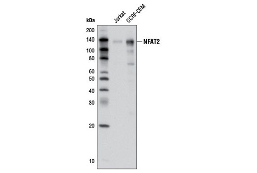 Western blot analysis of extracts from Jurkat and CCRF-CEM cells using NFAT2 (D15F1) Rabbit mAb.