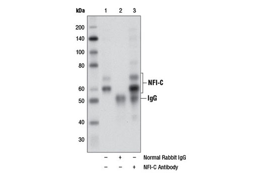 Immunoprecipitation of NFI-C from PANC-1 cell extracts using Normal Rabbit IgG #2729 (lane 2) or NFI-C Antibody (lane 3). Lane 1 is 10% input. Western blot analysis was performed using NFI-C Antibody.