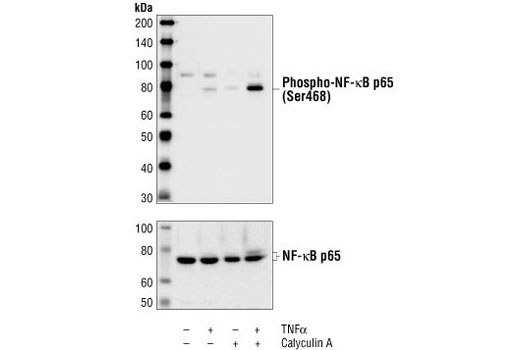 Western blot analysis of extracts from HeLa cells treated for 5 minutes with TNF-alpha #2169 (20 ng/ml), Calyculin A #9902 (50 nM), or both compounds, using Phospho-NF-kappaB p65 (Ser468) Antibody (top) or NF-kappaB p65 Antibody #3034 (bottom).