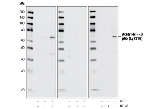 Western blot analysis of extracts from HeLa cells, mock transfected or transfected with NF-κB or NF-κB plus CBP, using Acetyl-NF-κB (Lys310) Antibody. Western blots were competed with acetylated peptide (middle) or non-acetylated peptide (right).