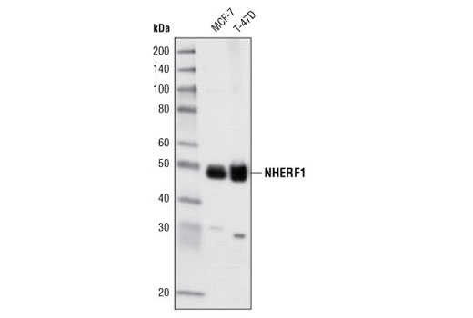 Western blot analysis of extracts from MCF-7 and T-47D cells using NHERF1 (A140) Antibody.