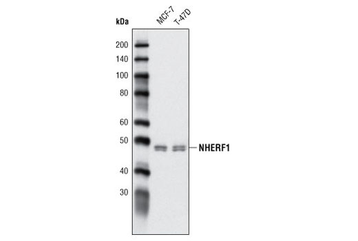 Western blot analysis of extracts from MCF-7 and T-47D cells using NHERF1 (A310) Antibody.