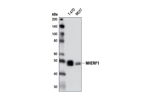 Western blot analysis of extracts from T-47D and MCF7 cells using NHERF1 (D1C10) Rabbit mAb.