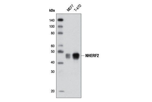 Western blot analysis of extracts from MCF7 and T-47D cells using NHERF2 (D3A5) Rabbit mAb.
