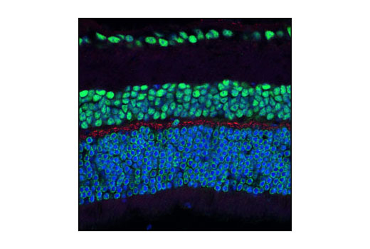 Confocal microscopic image of mouse retina labeled with Phospho-NMDAR1 (Ser890) Antibody (red) and CREB (86B10) Mouse mAb #9104 (green). Blue pseudeocolor stain = DRAQ5® (fluorescent DNA dye).