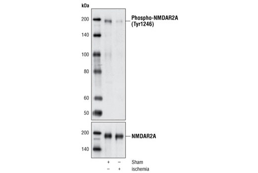 Western blot analysis of extracts from rat brain, either sham-operated or 15 min ischemia, using Phospho-NMDAR2A (Tyr1246) Antibody (upper) or NMDAR2A Antibody (lower).