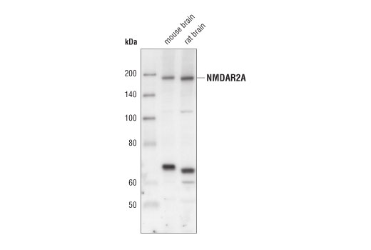 Western blot analysis of extracts from rat and mouse brain using NMDAR2A Antibody.