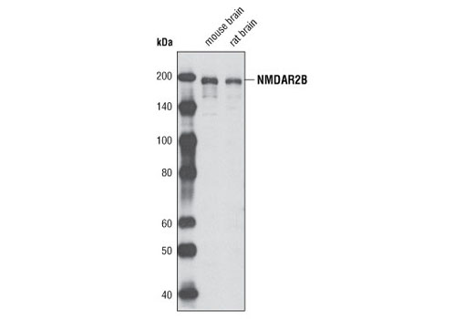 Western blot analysis of extracts from mouse and rat brain using NMDAR2B Antibody.