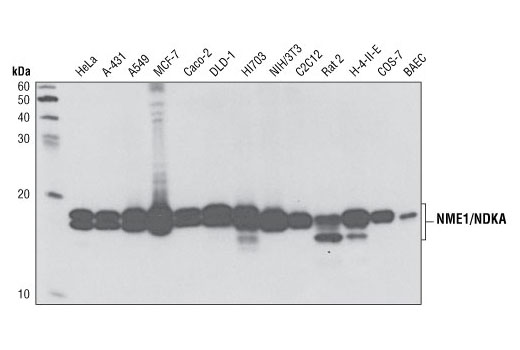 Western blot analysis of extracts from various cells lines using NME1/NDKA (D14H1) Rabbit mAb.