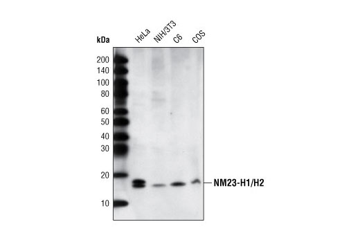 Western blot analysis of extracts from various cell lines using NME1/NDKA (D98) Antibody.