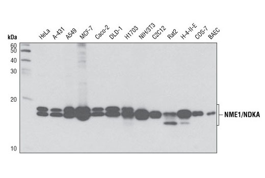 Western blot analysis of extracts from various cells lines using NME1/NDKA (D18F10) Rabbit mAb.