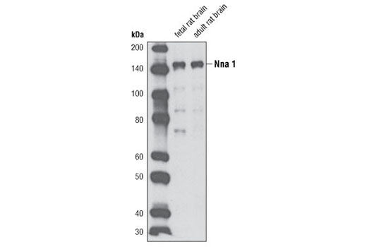 Western blot analysis of extracts from fetal and adult rat brain using Nna1 Antibody.