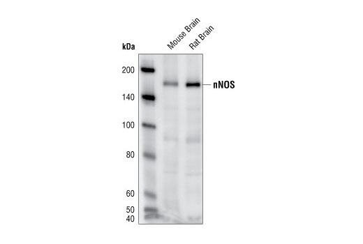 Western blot analysis of extracts from mouse and rat brain, using nNOS Antibody.