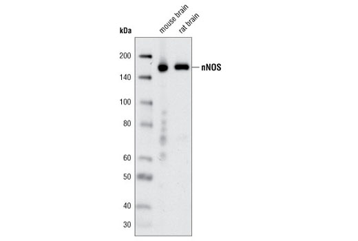 Western blot analysis of extracts from mouse and rat brain using nNOS (C12H1) Rabbit mAb.