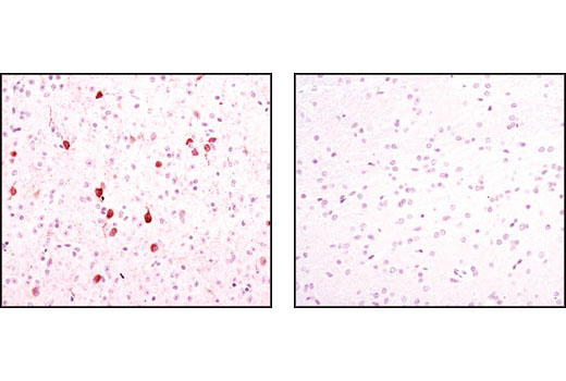 Immunohistochemical analysis of paraffin-embedded wild-type (+/+, left) or nNOS null (-/-, right) mouse brain, using nNOS (C12H1) Rabbit mAb.